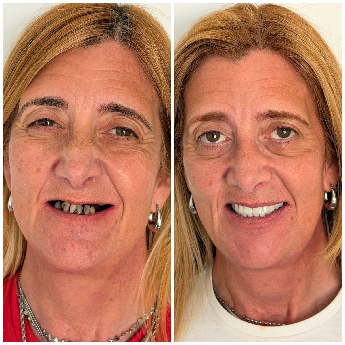Caso clínico — antes e depois