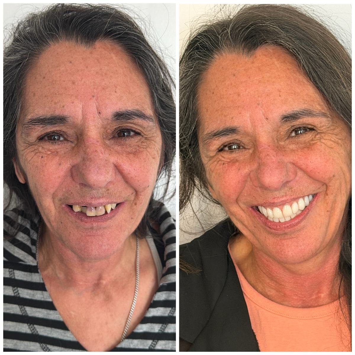 Caso clínico — antes e depois