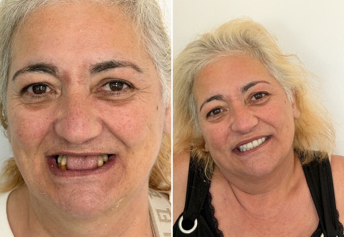 Caso clínico — antes e depois